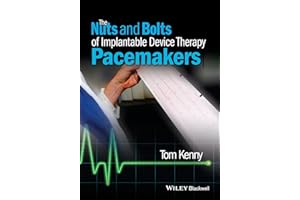 The Nuts and Bolts of Implantable Device Therapy: Pacemakers