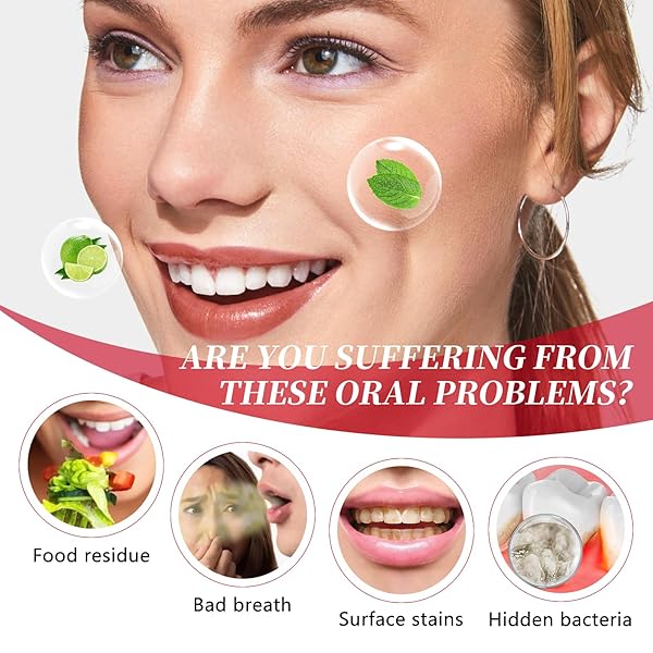 SP-10 PROBIOTIC WHITENING TOOTHPASTE – ULTRA WHITENING & STAIN REMOVAL, DEEP CLEANING, FRESH BREATH FORMULA WITH PROBIOTICS (1)