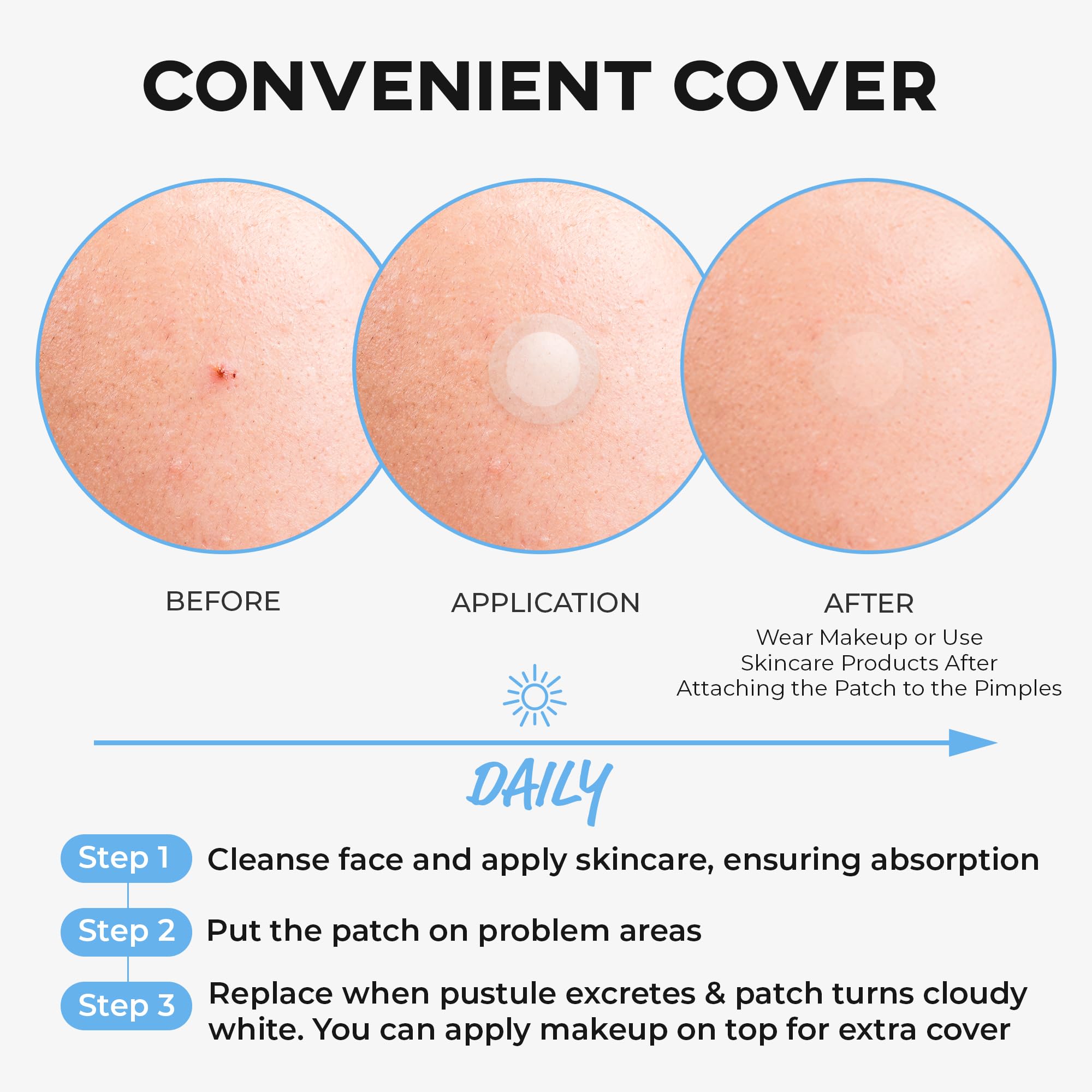 NOLAHOUR Hydrocolloid Patch STEP2 | Invisible Ultra-Thin Bandages | Vegan Patch for Pimple-Prone Skin | Korean Skin Care Face Pimple Patches (Pack of 1, 63 Patches)