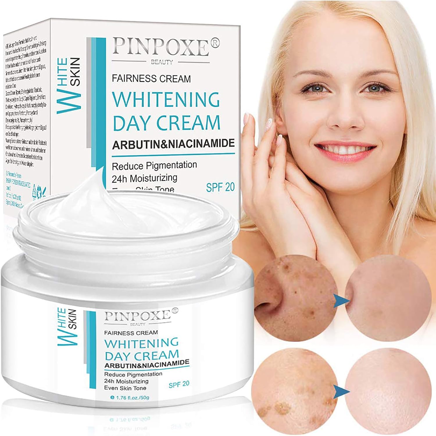 pinpoxe freckle cream