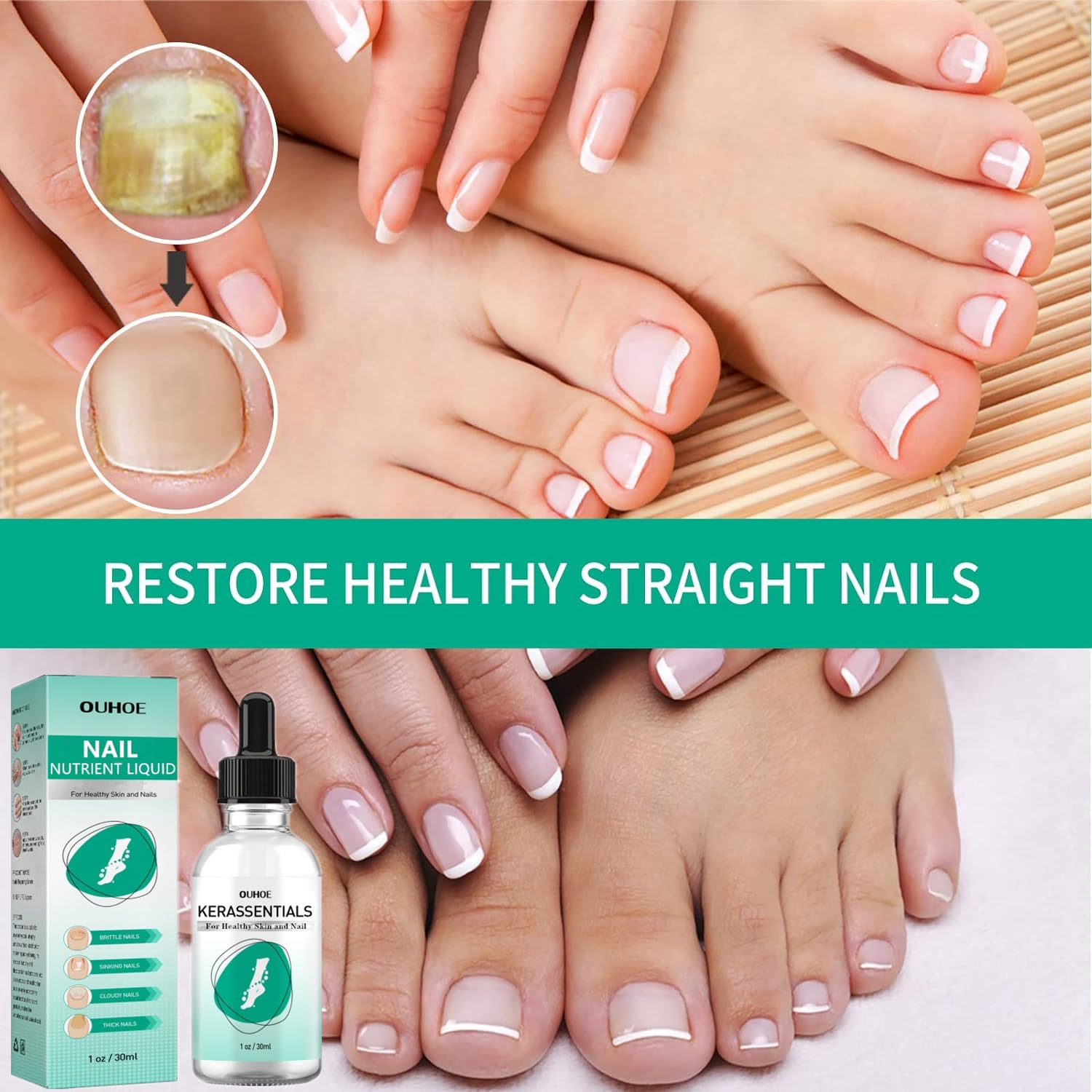 Kerassentials Toenail Oil, Kerassentials Nails colourless (3PCS) - Image 3