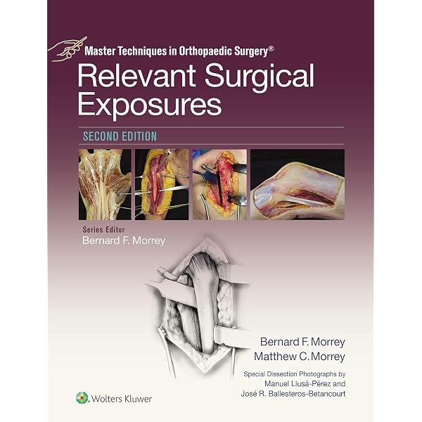 Amazon.com: Surgical Exposures in Orthopaedics: The Anatomic