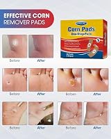 MYMULIKE Corn Removal Pads 48 Count Foot Care Cushion Plasters view 4