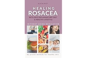 Healing Rosacea With Anti-inflammatory Diet And Healthy Lifestyle: My Proven Methods For Healthy Skin Without Using Medicatio
