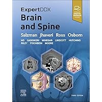 Amazon.com: ExpertDDx: Brain and Spine: 9780443106941