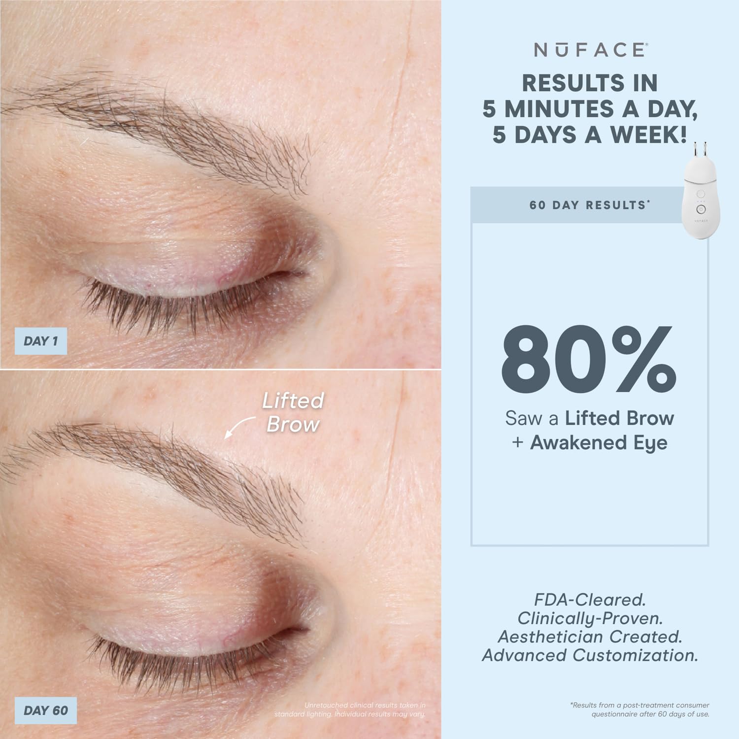 NuFACE TRINITY+ Effective Lip & Eye Attachment for Microcurrent Facial Device - FDA Cleared At Home Eye Lift & Smile Lines Treatment to Tighten & Tone Hard-to-Reach Areas Around Mouth and Eyes