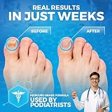 Imperial Feet Pedicure Foot Soak Tea Tree Oil Epsom Salt Athlete's Foot Fungal view 3