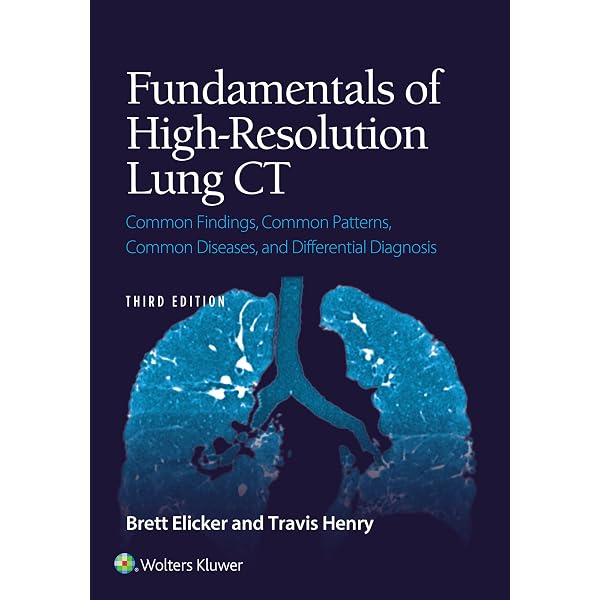 Webb, Müller and Naidich's High-Resolution CT of the Lung