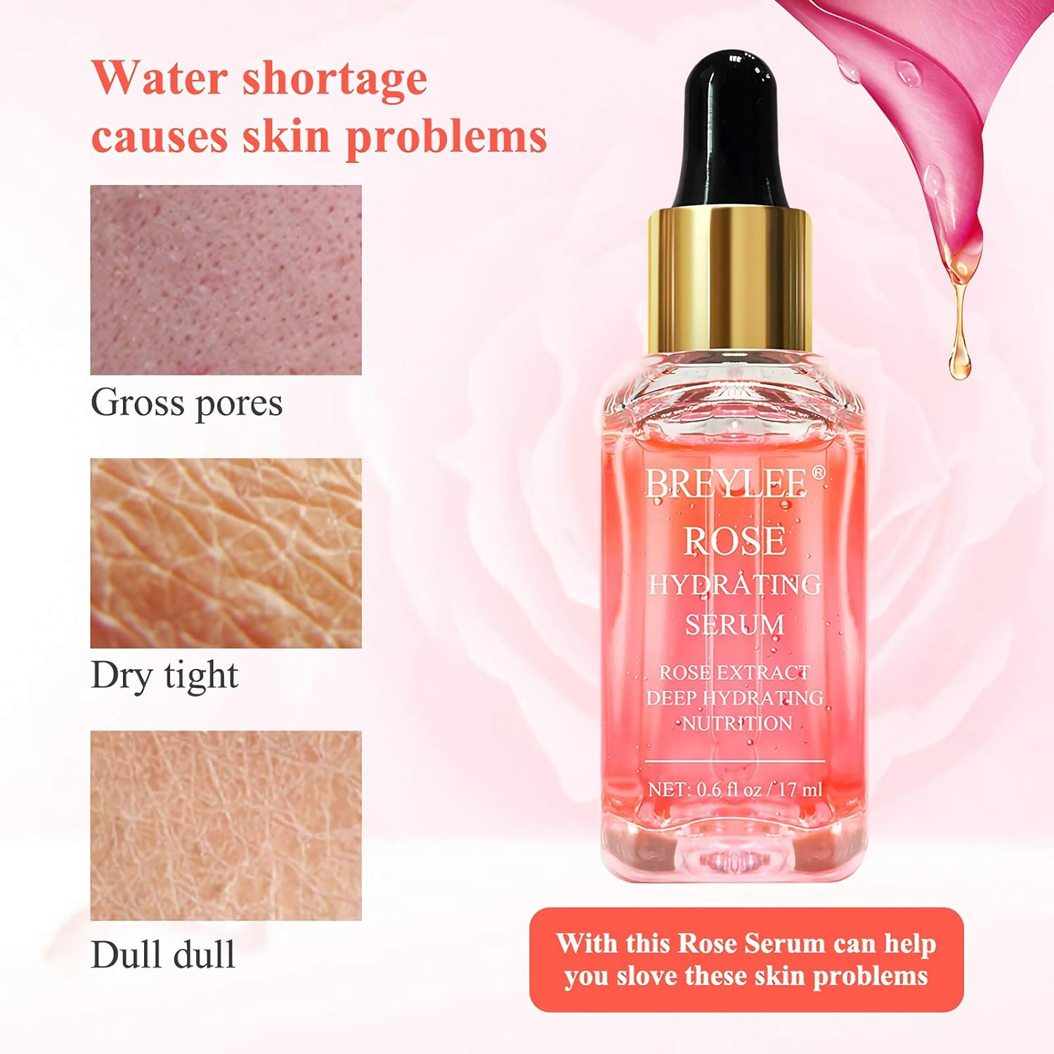 Rose Face Serum, BREYLEE Moisturizing Serum Hydrating Face Serum Rose Essence with Rose Petals Extract Hyaluronic Acid Trehalose B5 Vitamin Alcohol Free Facial Skin Care(17ml,0.6fl oz): Kitchen & Dining
