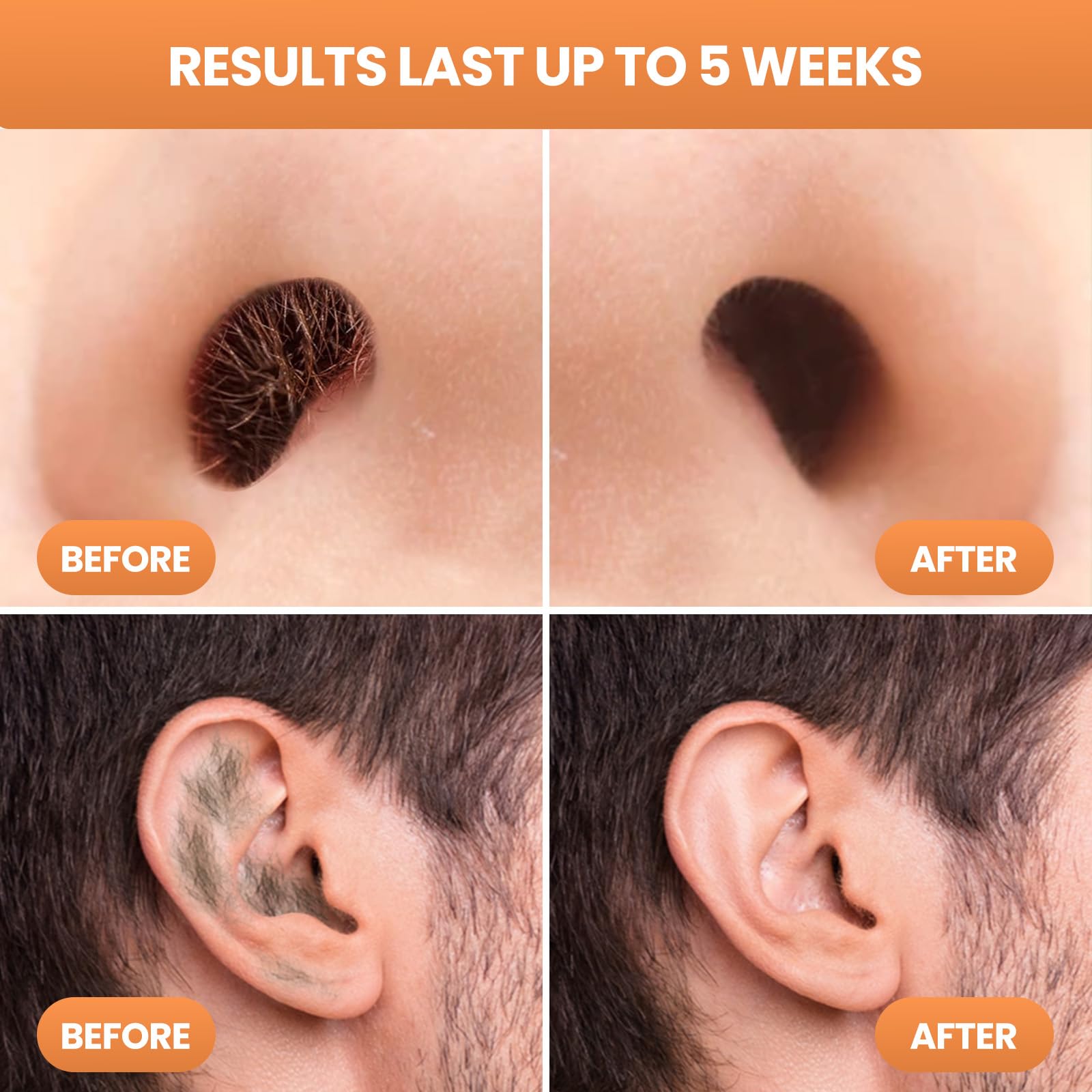 AUZEAL Nose Wax Kit Men With 30 Nose Waxing Sticks, Nose Hair Wax Kit With100g Wax, Up to 20 Uses, Safe, Quick and Painless Nose Hair Removal for Men