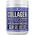 Collagen Peptides Powder for Women Hydrolyzed Collagen Supplement Powder Types I - III Non-GMO Grass-Fed Gluten-Free Kosher and Pareve Unflavored Easy to Mix Drink Healthy Hair Skin Joints Nails 1Lb