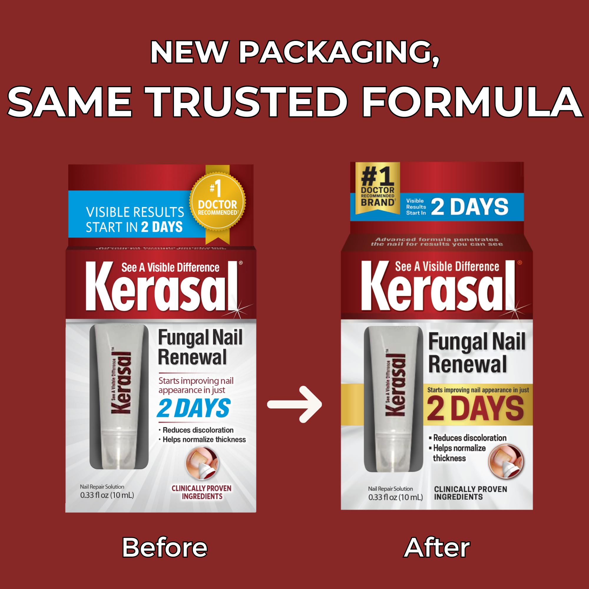 Kerasal Nail Renewal, Restores Appearance of Discolored or Damaged Nails, 0.33 fl oz (Packaging May Vary) - Image 5