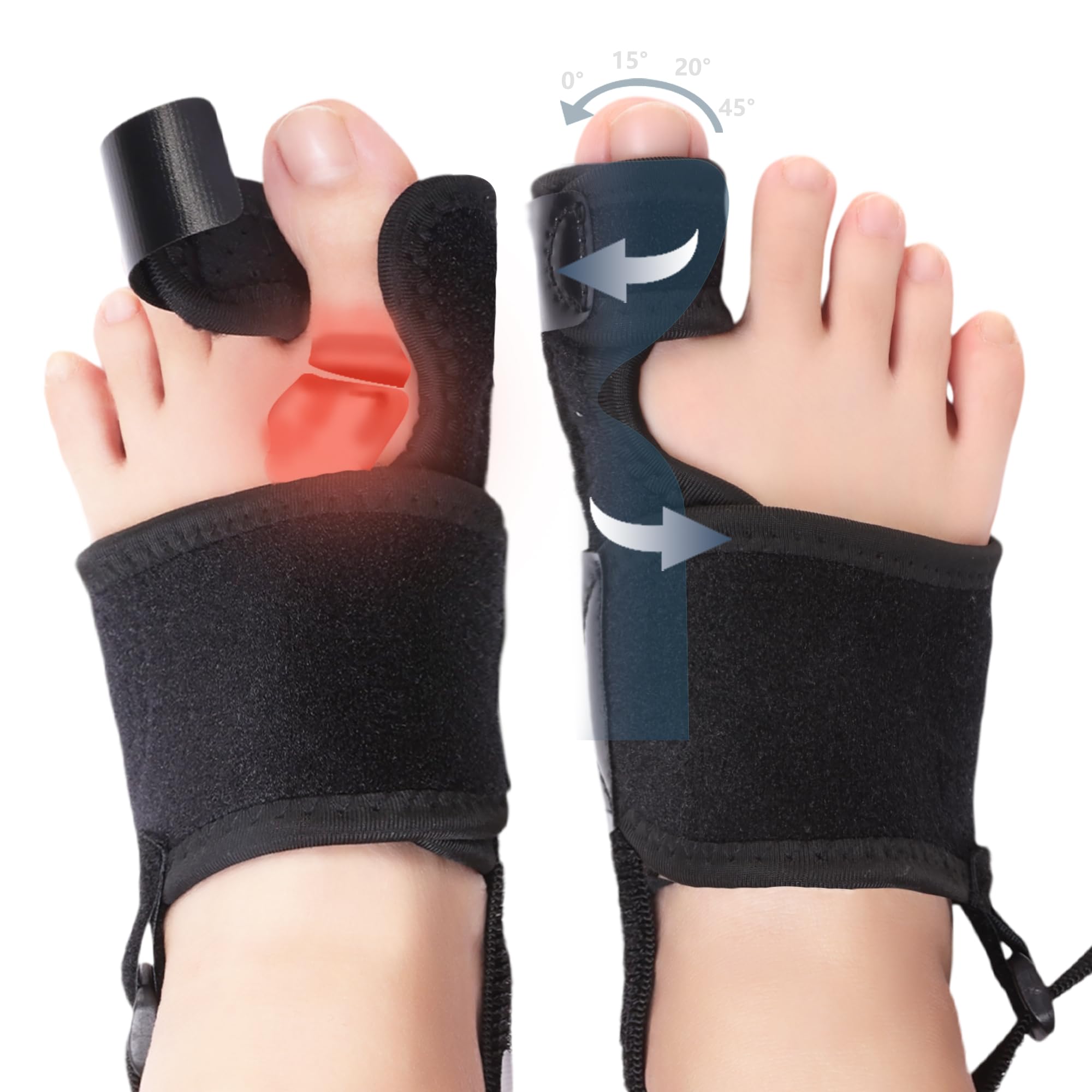 Photo 1 of Lonicerkz 2 Pack Bunion Corrector for Women & Men, Orthopedic Bunion Splint for Hallux Valgus Pain Relief, Big Toe Separator, Adjustable Day/Night Support, Comfortable Hammer Toe Straightener