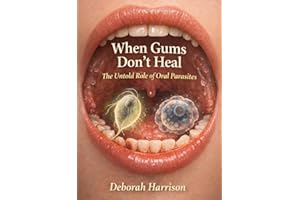 When Gums don’t Heal: The Untold Role of Oral Parasites