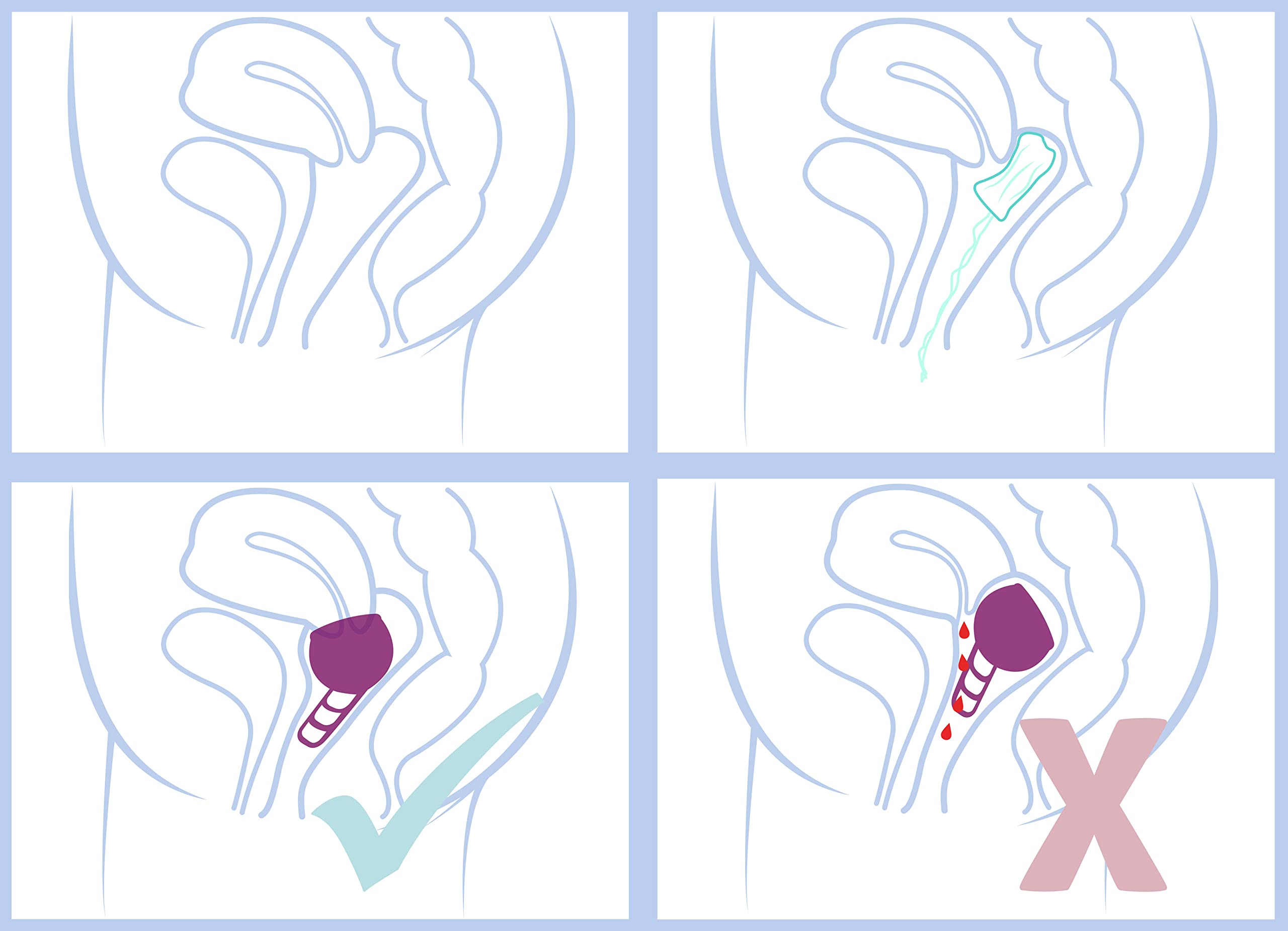 Merula Cup galaxy (violett) - One size Menstruationstasse aus medizinischem Silikon 4