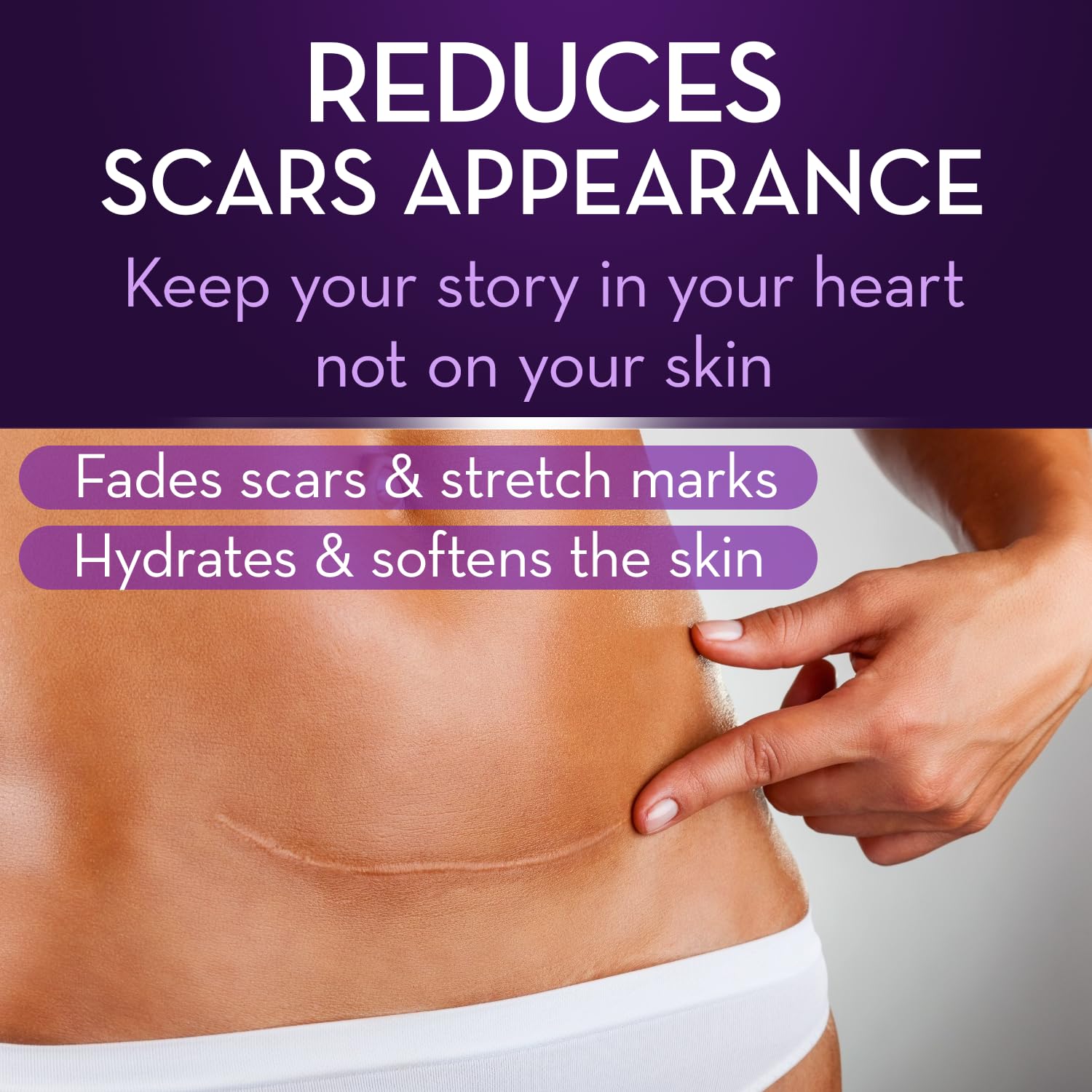 Cicatricure Advanced Scar Gel for Face & Body - Proven Results in 2 Weeks, Scar Treatment for Surgical Scars, Stretch Marks, Scars of Burns and Injuries, Acne Scar Treatment, 1 oz (28 g)