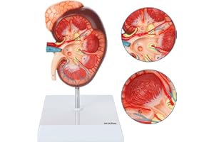Axis Scientific Kidney Anatomy Model with Adrenal Gland, Anatomically Correct, Durable Design Perfect for Students, Teachers or Doctor's Offices, Includes Base