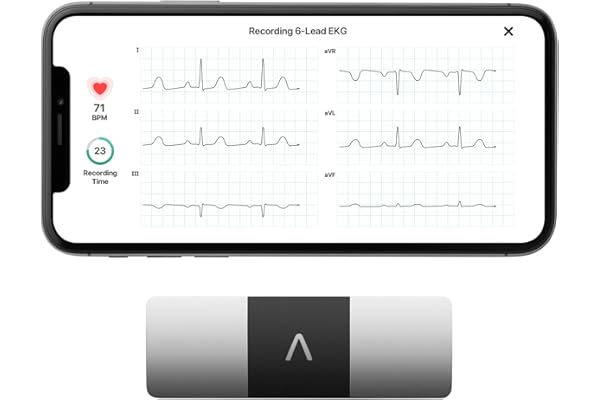 KardiaMobile 6-Lead Personal EKG Monitor – Six Views of The Heart – Detects AFib and Irregular Arrhythmias – Instant Results in 30 seconds – Works with Most Smartphones - FSA/HSA Eligible