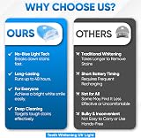 Infinitive Beauty Teeth Whitening LED Light for Home Use – Speed Up Whiteness view 5
