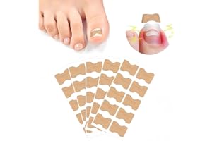 Ingrown Toenail Corrector Strips Toenail Correction Patch 50 Pcs Nail Strips Ingrown Toenail Treatment Paronychia Toe Nail Fi