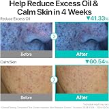numbuzin No.1 Cream Pantothenic B5 Oil Control Acne Soothing Moisturizer 80ml view 3