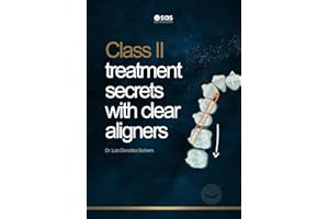 Class II treatment secrets with clear aligners: Optimizing Class II Treatment with Clear Aligners: Advanced Techniques and Ef