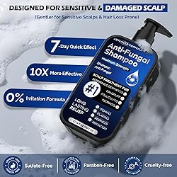 Antifungal Shampoo for Seborrheic
