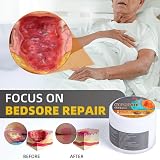 Jinjiar 50g Bed Sore Cream, Healing Gel for Wounds & Pressure Sores view 2