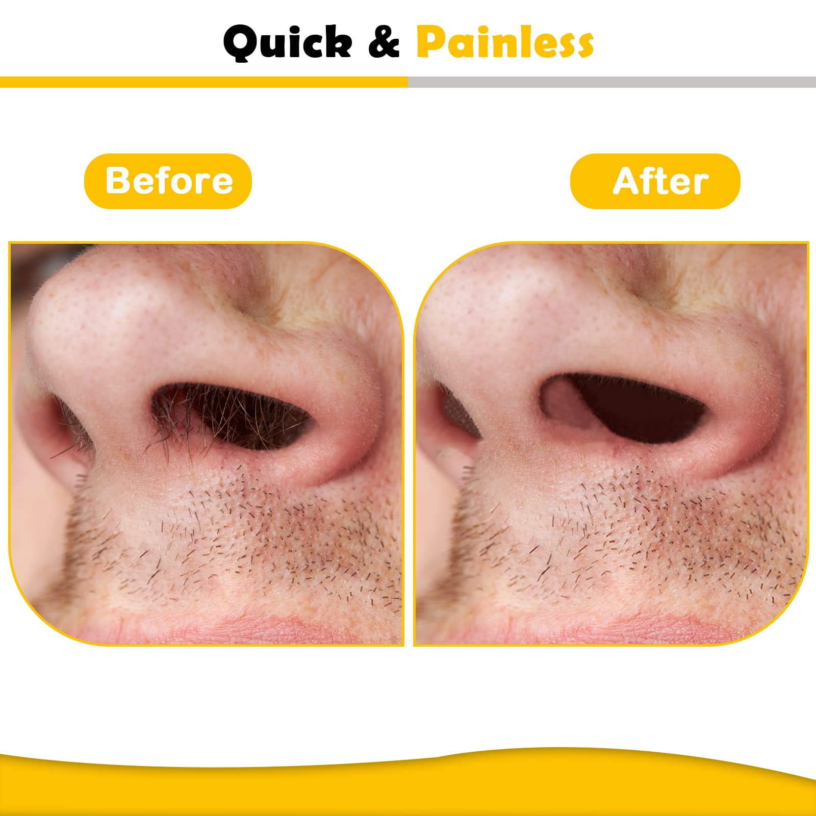 120g Nose Hair Waxing Kit with 40 Applicators - Quick & Painless Hair Remover for Men and Women, Up to 20 Uses