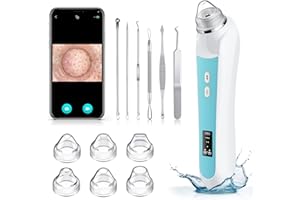 OTTLEBA Blackhead Remover Vacuum, Black Head Extractions Tool with Camera for USB Interface Type Pore Vacuum, Men and Women Pore Cleaner, 6 Suction Heads & 3 Adjustment Modes (Blue)