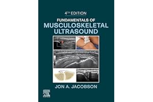 Fundamentals of Musculoskeletal Ultrasound,E-Book (Fundamentals of Radiology)