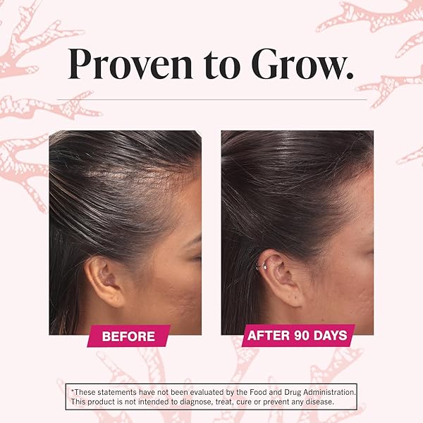 VIVISCAL HAIR GROWTH SUPPLEMENTS FOR WOMEN, CLINICALLY PROVEN HAIR GROWTH PRODUCT WITH PROPRIETARY COLLAGEN COMPLEX, RESULTS OF THICKER, FULLER HAIR NOURISH HAIR LOSS, 180 TABLETS – 3 MONTH SUPPLY