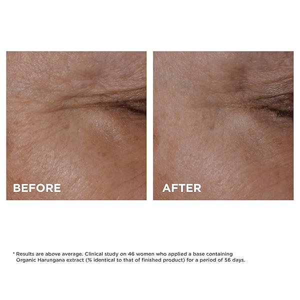 CLARINS TOTAL EYE LIFT | ANTI-AGING EYE CREAM | TARGETS WRINKLES, CROW’S FEET, DARK CIRCLES, AND PUFFINESS FOR A VISIBLE EYE LIFT IN 60 SECONDS FLAT*| INGREDIENTS OF 94% NATURAL ORIGIN