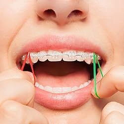 JMU Orthodontic Elastics 3/16 Inch Medium Neon