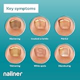 Nailner Fungal Nail Brush 5 ml Treat & Prevent Fungal Nail Infection view 3