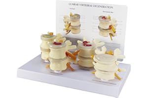 GPI Anatomicals - 4-Stage Vertebrae Model, Spine Model for Human Anatomy and Physiology Education, Anatomy Model for Doctor's Office and Classrooms, Medical Learning Resources
