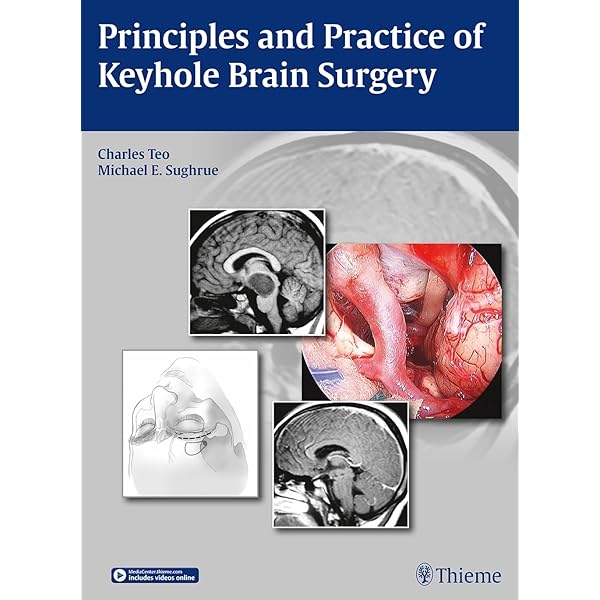 Principles and Practice of Keyhole Brain Surgery: 9783131758514