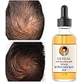 Ginger Hair Growth Serum - Treats Thinning, Hair Loss, Dry & Itchy Scalp, Dandruff - Hair Regrowth Treatment for Men and Women - 2OZ