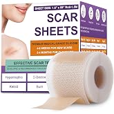 Silicone Scar Sheets, Medical Grade Silicone Scar Tape for Old &amp; New Scars | Scar Tape for Surgical, Hypertrophic, Keloid, C-Section, Burn Scars, Reusable Professional Scars Removal (1.6"X59" Roll-1.5M)