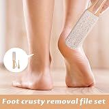 Nuqin 2pk Pumice Stone for Feet - Double Sided Foot File for Dead Skin view 4