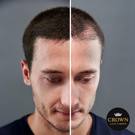 Buy 0 87oz 25g Medium Brown Crown Hair Fibers Best Keratin