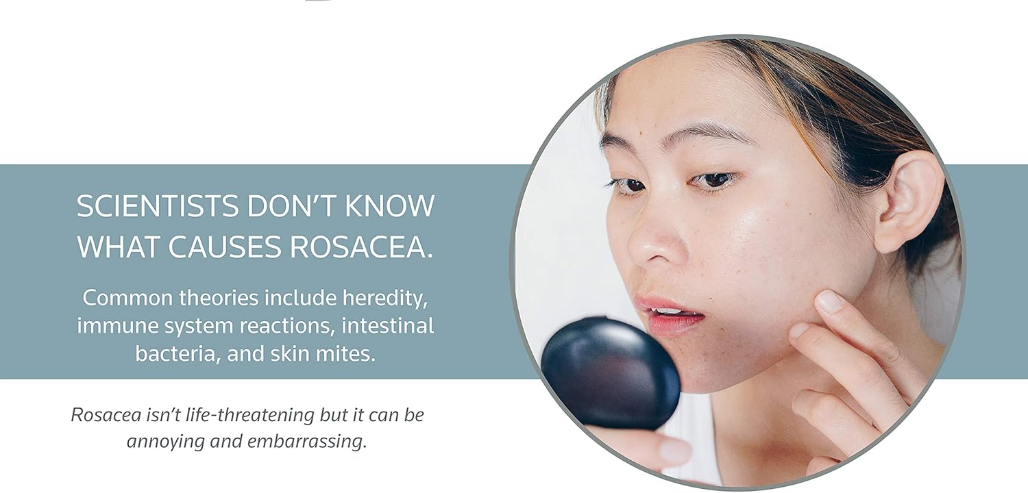 Prosacea – Controls Maskne Rosacea Symptoms of Redness, Pimples & Irritation – 0.75 Oz: Health & Personal Care