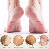 Eruinfang Foot File Double Sided Wooden Foot Rasp Hard Skin Remover view 3