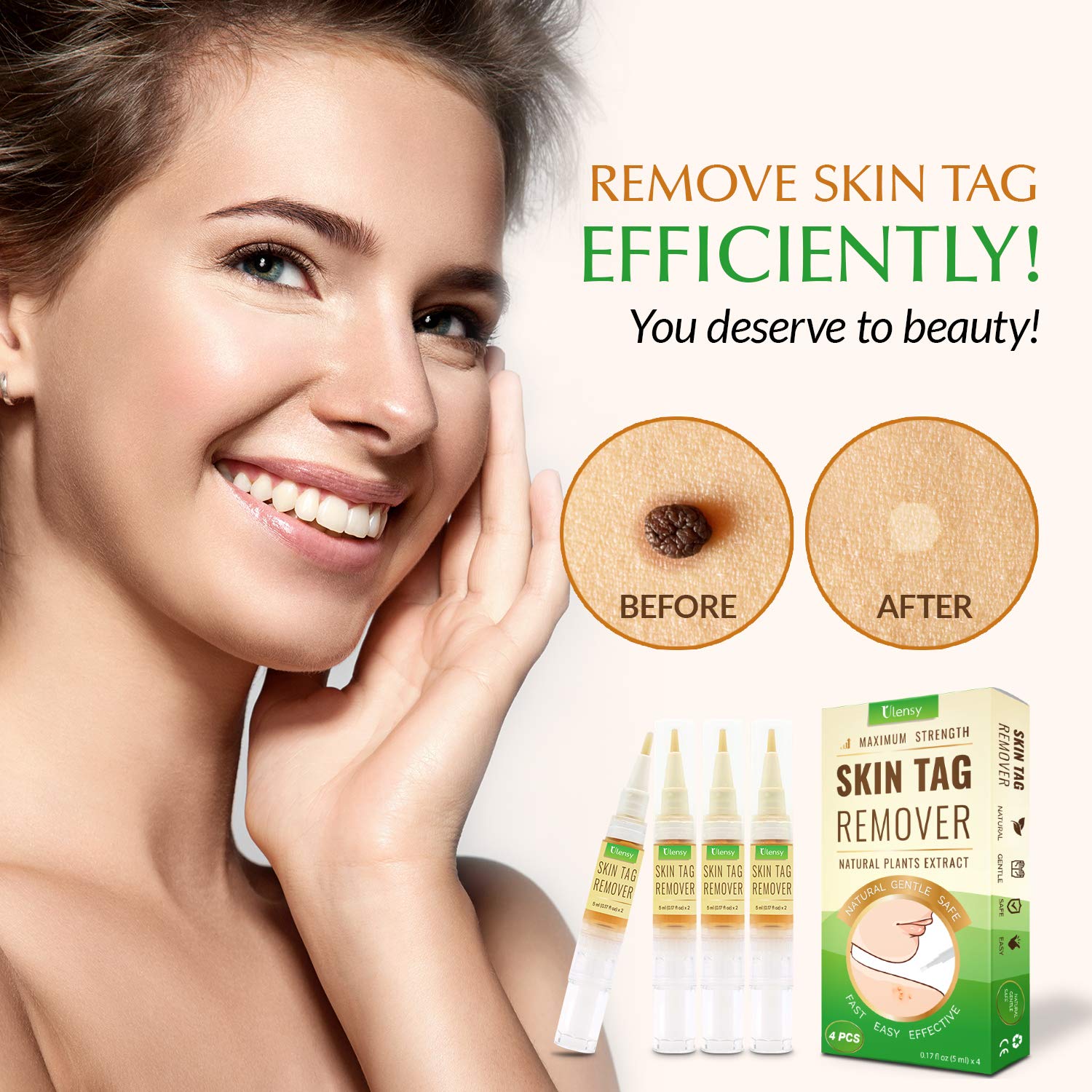 Ulensy 4 PCS Skin Tag Remover with Advanced Formula, Remove Skin Tag Efficiently, Easy and Fast-Acting Skin Tag Remover, 20 ML : Beauty
