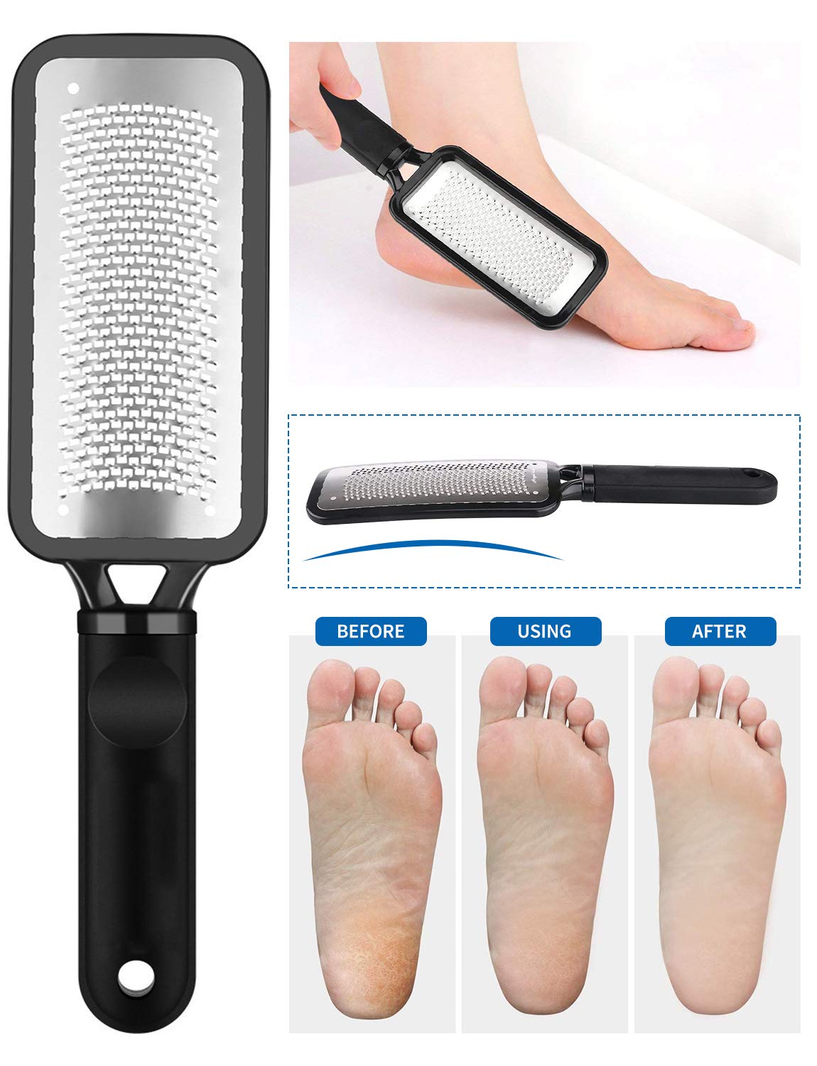 Colossal Foot Rasp Foot File and Callus Remover, 3 in 1 Foot Care Pedicure Set Tool for Hard Skin Cuticle Remover, Can be Used on Both Wet and Dry Feet, Surgical Grade Stainless Steel File: Beauty