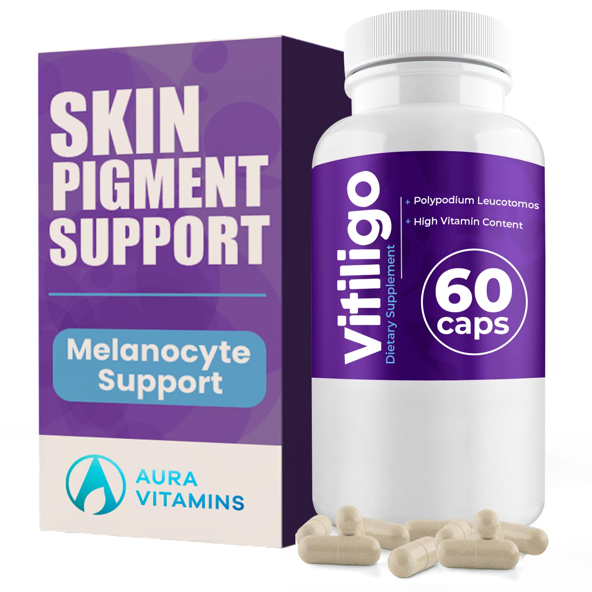 Vitiligo