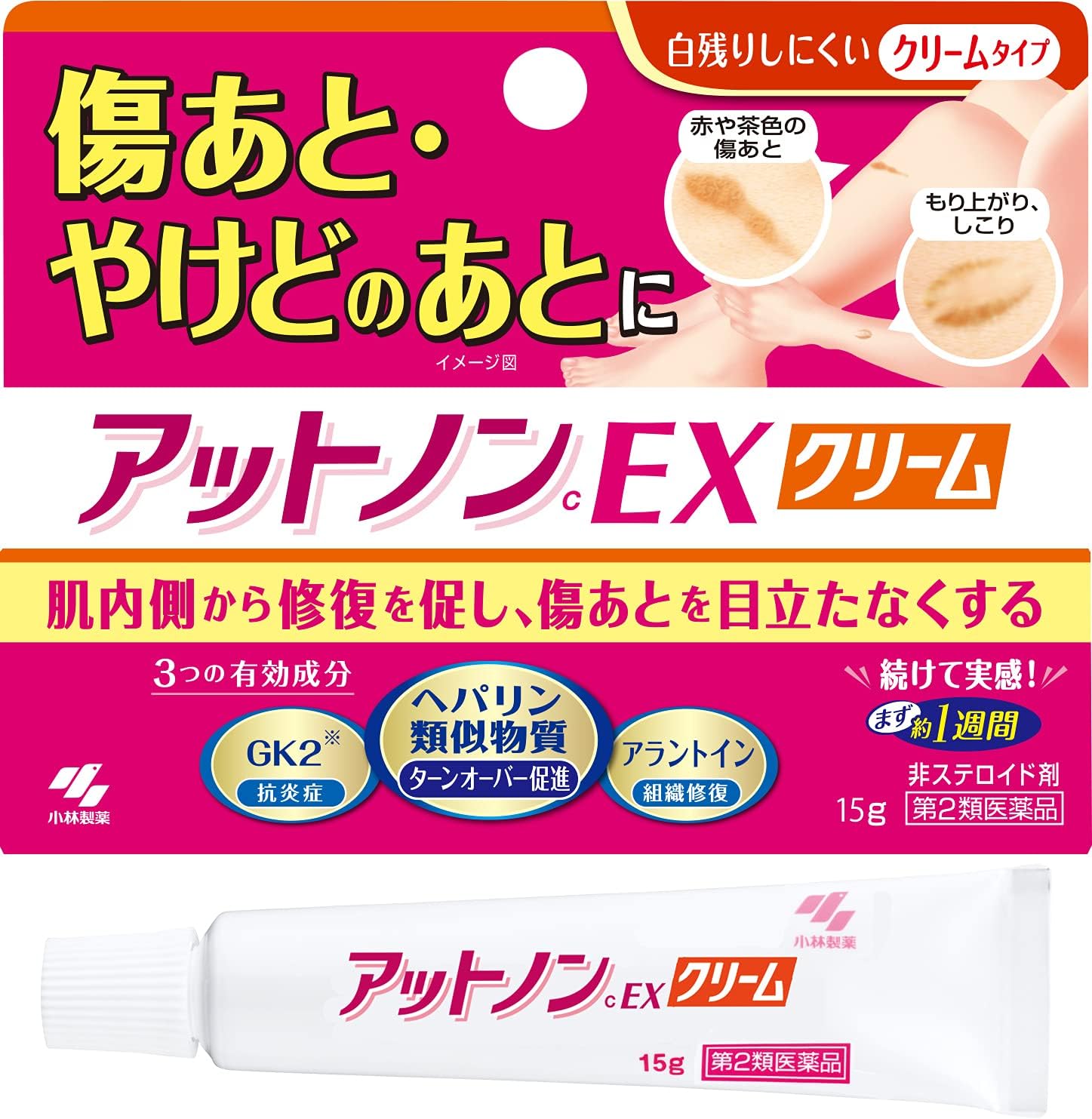 Amazon 第2類医薬品 アットノンex クリーム 15g アットノン 皮膚用治療薬