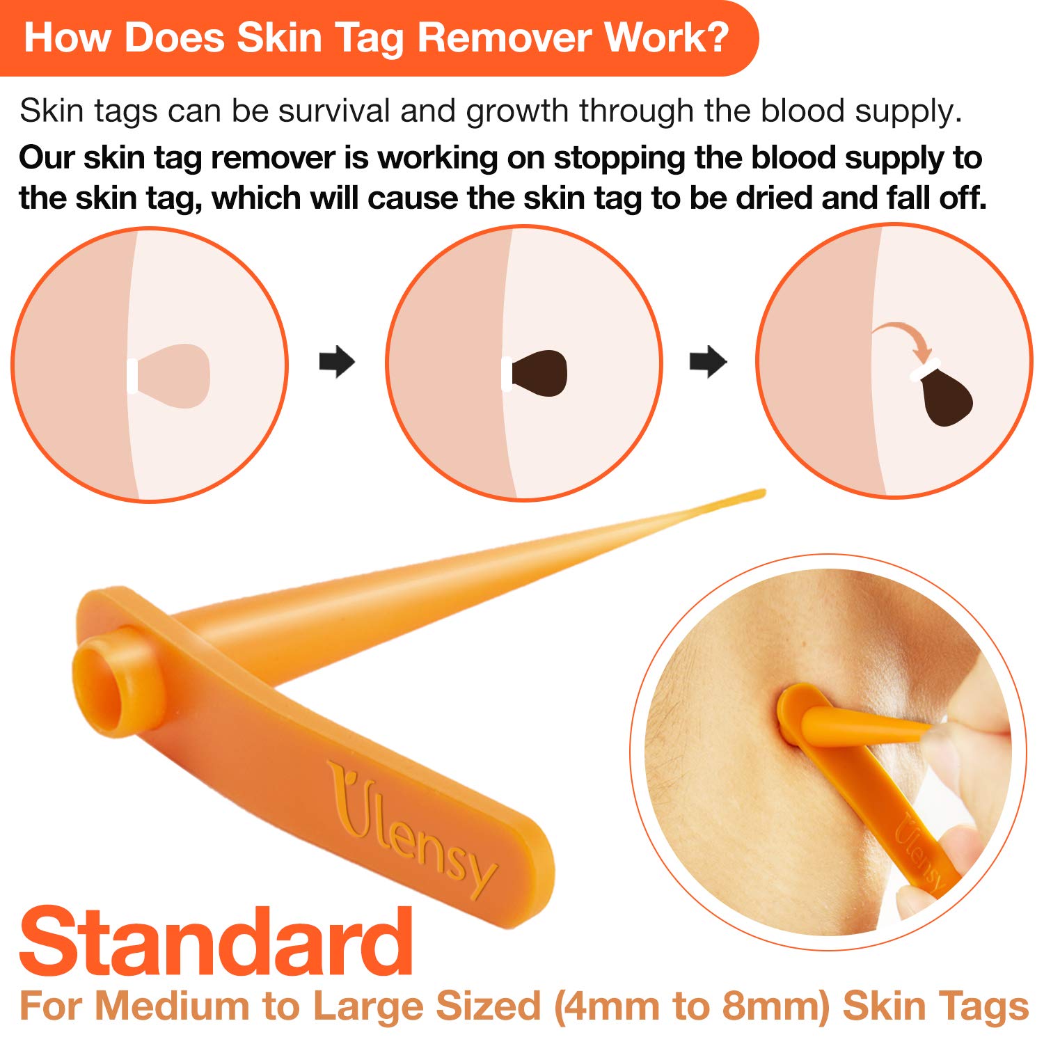 Ulensy Skin Tag Remover, Standard Skin Tag Removal Kit with 36Pcs Repair Patches for Face, Neck, Finger and Body, for Medium to Large (4mm to 8mm) Sized Skin Tags, Safe and Painless, Smooth Results : Beauty
