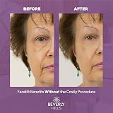 BEVERLY HILLS Instant Facelift Eye Serum 30ml Argireline Hyaluronic Acid view 6