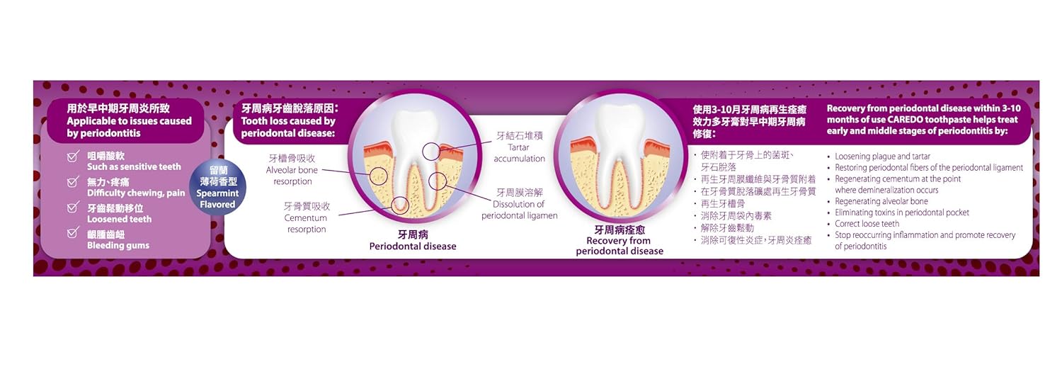 CAREDO Healing Periodontitis Toothpaste, The ONLY Toothpaste Cure Early Medium Term Periodontitis, Remove Dental Calculus, Avoid Loosening and Falling Off Teeth (100g, 2 counts) : Beauty